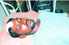 SSF activists assaulted allegedly by Sangh Parivar members